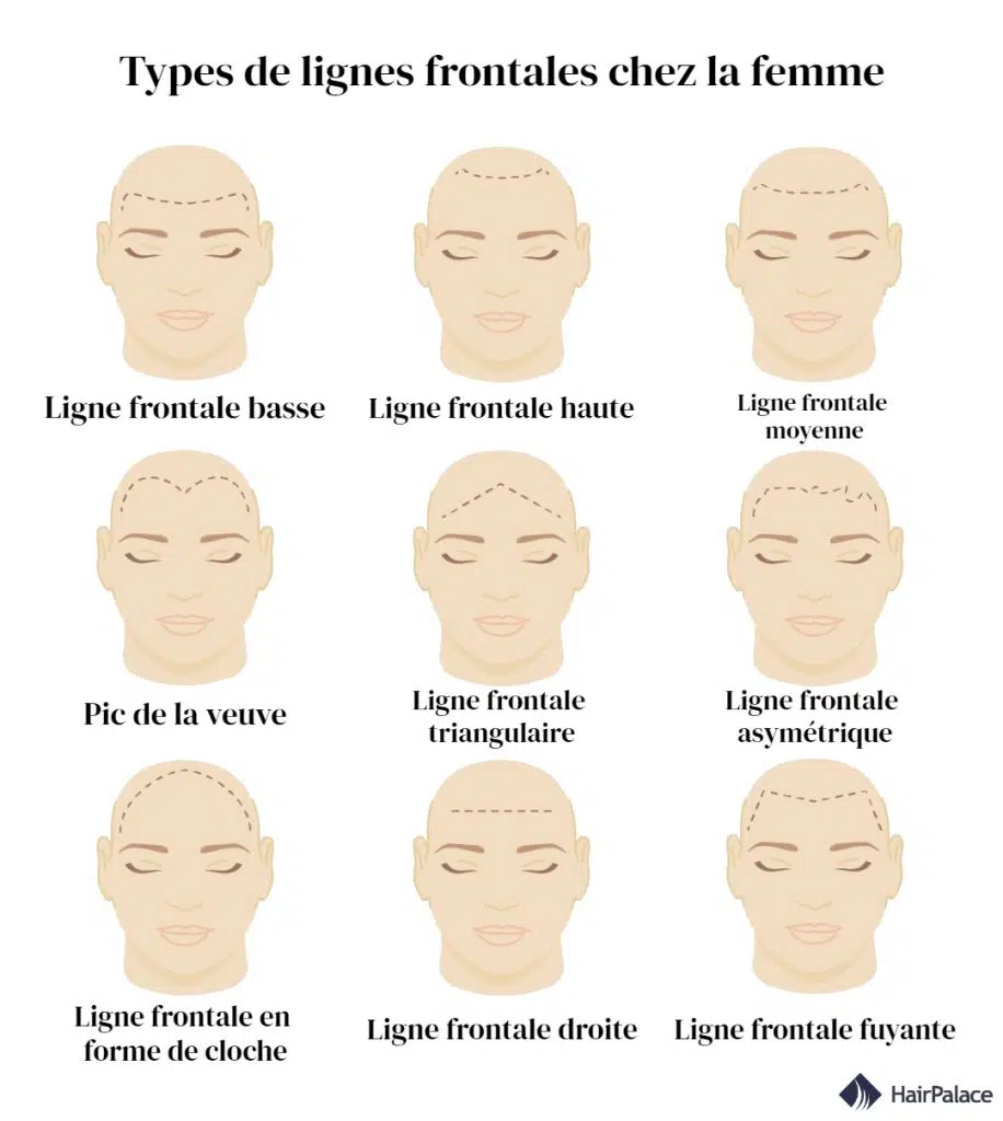 Les racines des cheveux Types-de-lignes-frontales-chez-la-femme-916x1024.jpg