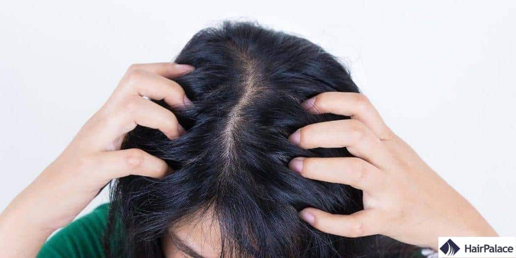 Un cuir chevelu qui démange peut provoquer une perte de cheveux.