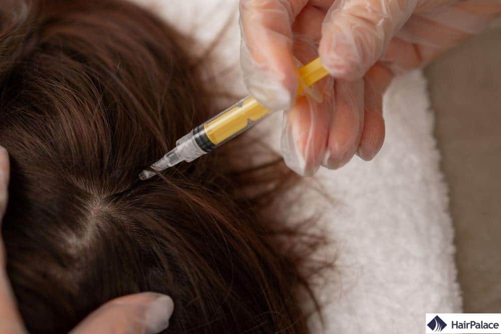 mésothérapie pour les injections dans les cheveux